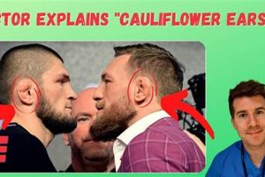 Prevent MMA Fighting Ears: Causes & Treatment Ultimate Guide to MMA: Training, Techniques, and Top Fighters in The World Prevent MMA Fighting Ears: Causes & Treatment | Ultimate Guide to MMA: Training, Techniques, and Top Fighters in The World
