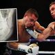 MMA Broken Jaw: Causes, Prevention & Recovery | Ultimate Guide to MMA: Training, Techniques, and Top Fighters in The World