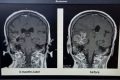 MMA Fighters & Brain Injury Risks Ultimate Guide to MMA: Training, Techniques, and Top Fighters in The World MMA Fighters & Brain Injury Risks | Ultimate Guide to MMA: Training, Techniques, and Top Fighters in The World