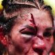 UFC's Aldana MMA: Flyweight Contender | Ultimate Guide to MMA: Training, Techniques, and Top Fighters in The World