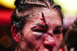 Top 5 Worst MMA Cuts: Gruesome Injuries Ultimate Guide to MMA: Training, Techniques, and Top Fighters in The World Top 5 Worst MMA Cuts: Gruesome Injuries | Ultimate Guide to MMA: Training, Techniques, and Top Fighters in The World
