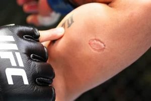 Infamous MMA Bite Incidents on Reddit Ultimate Guide to MMA: Training, Techniques, and Top Fighters in The World Infamous MMA Bite Incidents on Reddit | Ultimate Guide to MMA: Training, Techniques, and Top Fighters in The World