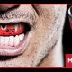 Top 5 Best MMA Mouthguards for 2024 | Ultimate Guide to MMA: Training, Techniques, and Top Fighters in The World