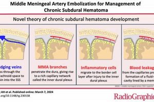 What is MMA Embolization? A Simple Guide Ultimate Guide to MMA: Training, Techniques, and Top Fighters in The World What is MMA Embolization? A Simple Guide | Ultimate Guide to MMA: Training, Techniques, and Top Fighters in The World