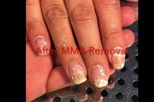 MMA Nails: Dangers, Safety & Alternatives Ultimate Guide to MMA: Training, Techniques, and Top Fighters in The World MMA Nails: Dangers, Safety & Alternatives | Ultimate Guide to MMA: Training, Techniques, and Top Fighters in The World