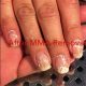 MMA Nails: Dangers, Safety & Alternatives | Ultimate Guide to MMA: Training, Techniques, and Top Fighters in The World