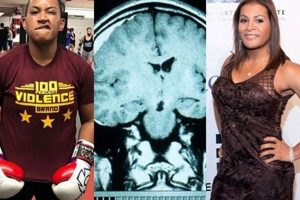 Dangers of Cracked Skulls in MMA Fights Ultimate Guide to MMA: Training, Techniques, and Top Fighters in The World Dangers of Cracked Skulls in MMA Fights | Ultimate Guide to MMA: Training, Techniques, and Top Fighters in The World