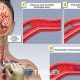 Mma Embolism | Ultimate Guide to MMA: Training, Techniques, and Top Fighters in The World