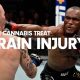 Understanding MMA Brain Injury Risks & Prevention | Ultimate Guide to MMA: Training, Techniques, and Top Fighters in The World