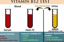 MMA Test & Vitamin B12 Deficiency: A Guide Ultimate Guide to MMA: Training, Techniques, and Top Fighters in The World MMA Test & Vitamin B12 Deficiency: A Guide | Ultimate Guide to MMA: Training, Techniques, and Top Fighters in The World