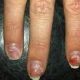 Mma Nail Damage | Ultimate Guide to MMA: Training, Techniques, and Top Fighters in The World