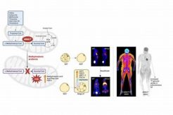 Understanding MMA Genetic Disease: Causes & Treatments Ultimate Guide to MMA: Training, Techniques, and Top Fighters in The World Understanding MMA Genetic Disease: Causes & Treatments | Ultimate Guide to MMA: Training, Techniques, and Top Fighters in The World