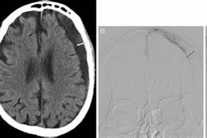 Advanced MMA CT Scans for Injury Analysis Ultimate Guide to MMA: Training, Techniques, and Top Fighters in The World Advanced MMA CT Scans for Injury Analysis | Ultimate Guide to MMA: Training, Techniques, and Top Fighters in The World