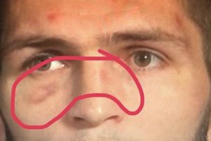 Khabib's Bleeding Moments: Impact & Significance Ultimate Guide to MMA: Training, Techniques, and Top Fighters in The World Khabib's Bleeding Moments: Impact & Significance | Ultimate Guide to MMA: Training, Techniques, and Top Fighters in The World