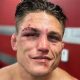 Dangerous MMA Weight Cuts: Risks & Regulations | Ultimate Guide to MMA: Training, Techniques, and Top Fighters in The World