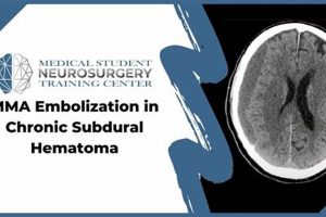 MMA Embolization for Subdural Hematoma Treatment | Ultimate Guide to MMA: Training, Techniques, and Top Fighters in The World