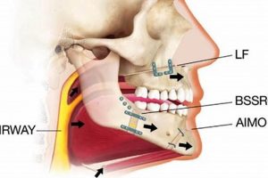 MMA Fighters & Sleep Apnea: A Guide Ultimate Guide to MMA: Training, Techniques, and Top Fighters in The World MMA Fighters & Sleep Apnea: A Guide | Ultimate Guide to MMA: Training, Techniques, and Top Fighters in The World