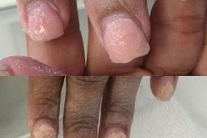 MMA Nail Products: Risks & Safer Alternatives Ultimate Guide to MMA: Training, Techniques, and Top Fighters in The World MMA Nail Products: Risks & Safer Alternatives | Ultimate Guide to MMA: Training, Techniques, and Top Fighters in The World