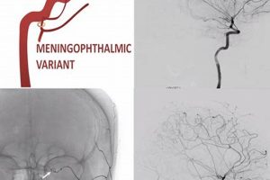 Understanding MMA Embolization Side Effects & Risks | Ultimate Guide to MMA: Training, Techniques, and Top Fighters in The World