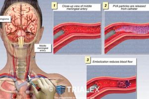MMA Embolization CPT Codes & Billing Guide | Ultimate Guide to MMA: Training, Techniques, and Top Fighters in The World