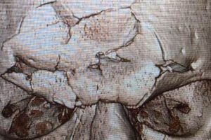 Mma Skull Fracture Ultimate Guide to MMA: Training, Techniques, and Top Fighters in The World Mma Skull Fracture | Ultimate Guide to MMA: Training, Techniques, and Top Fighters in The World