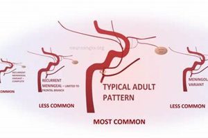 MMA Embolization: A Fighter's Guide | Ultimate Guide to MMA: Training, Techniques, and Top Fighters in The World